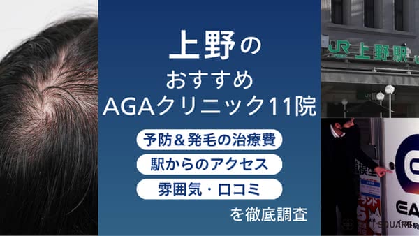 上野・御徒町のおすすめAGAクリニック11選|薄毛治療が安くても後悔しない院を徹底比較