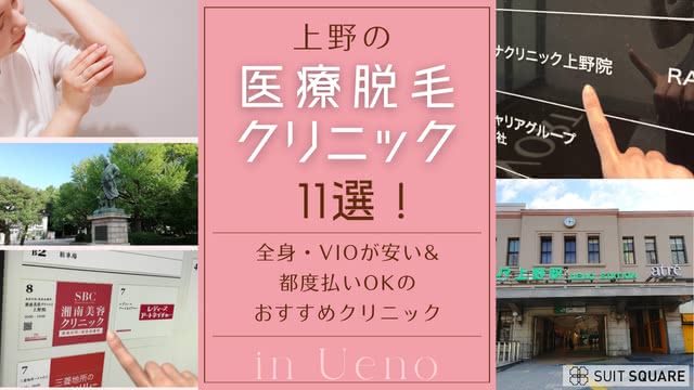 上野の医療脱毛おすすめ11選のアイキャッチ