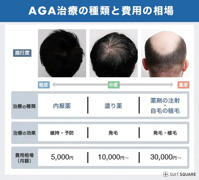 AGA治療の種類と費用の相場をまとめた画像