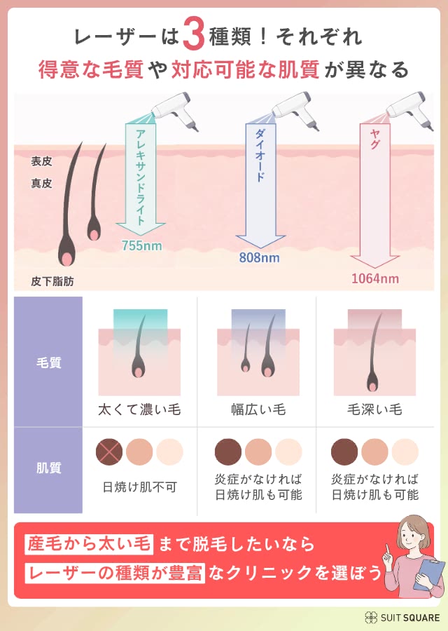 医療脱毛クリニックの選び方①脱毛機