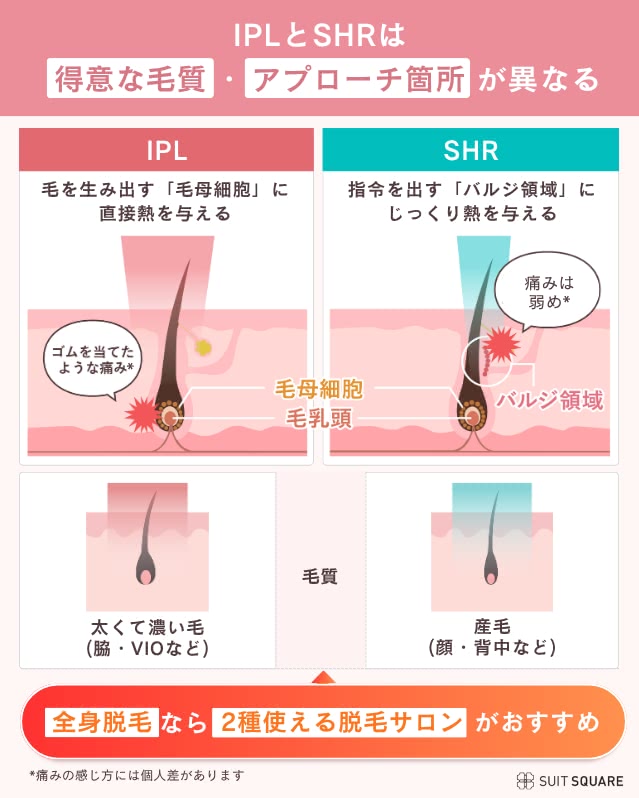 IPLとSHRの脱毛機の違い