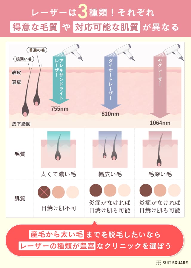 レーザーの画像