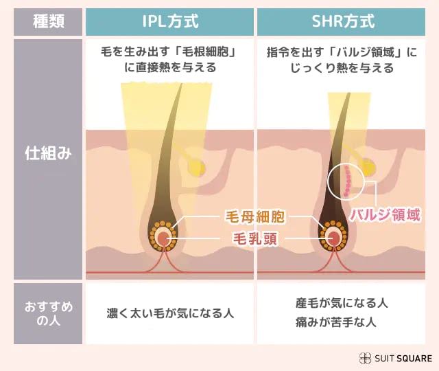 IPLとSHRの脱毛機の違い