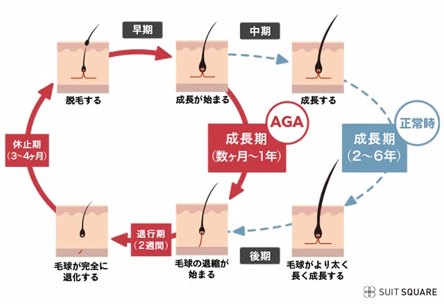 AGAの人のヘアサイクル