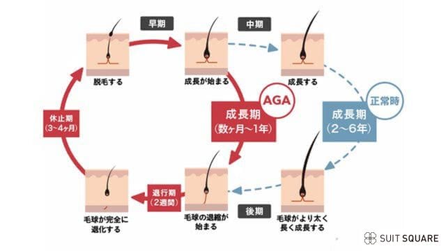 AGAのヘアサイクル