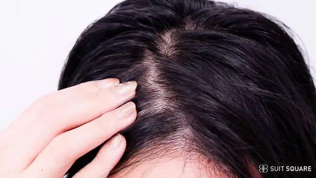 薄毛を気にしている女性のイメージ画像