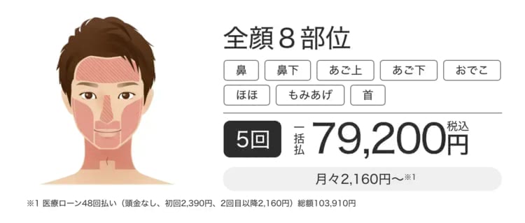 エミナルクリニックメンズ（メンズエミナル）のヒゲ脱毛6部位セレクトプラン