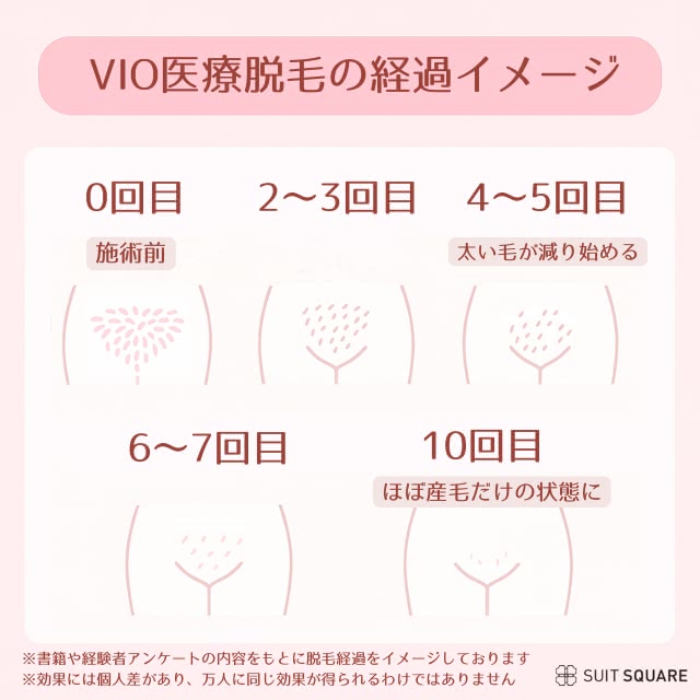VIO脱毛の経過