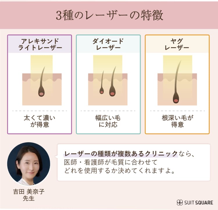 3種類のレーザーの特徴