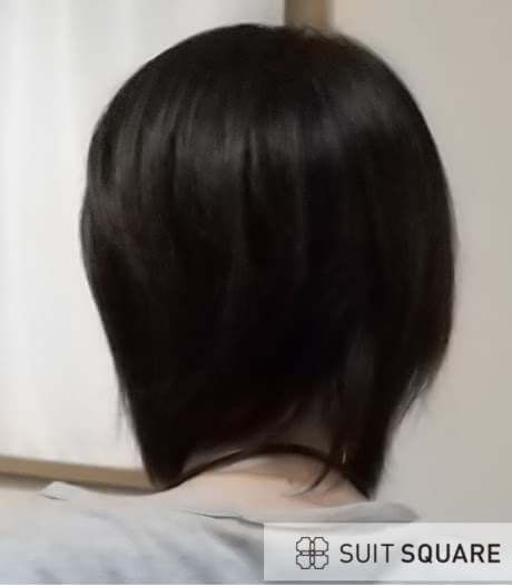 リゼクリニックの経験者