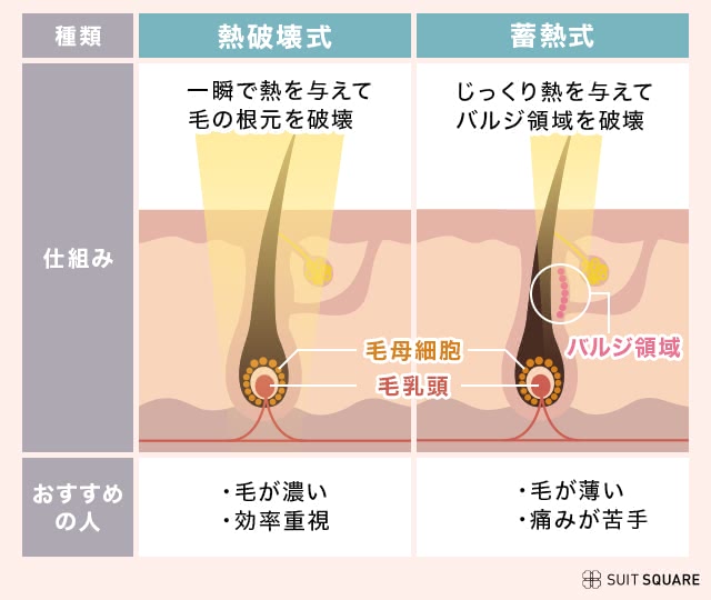 熱破壊式と蓄熱式の脱毛機の違い