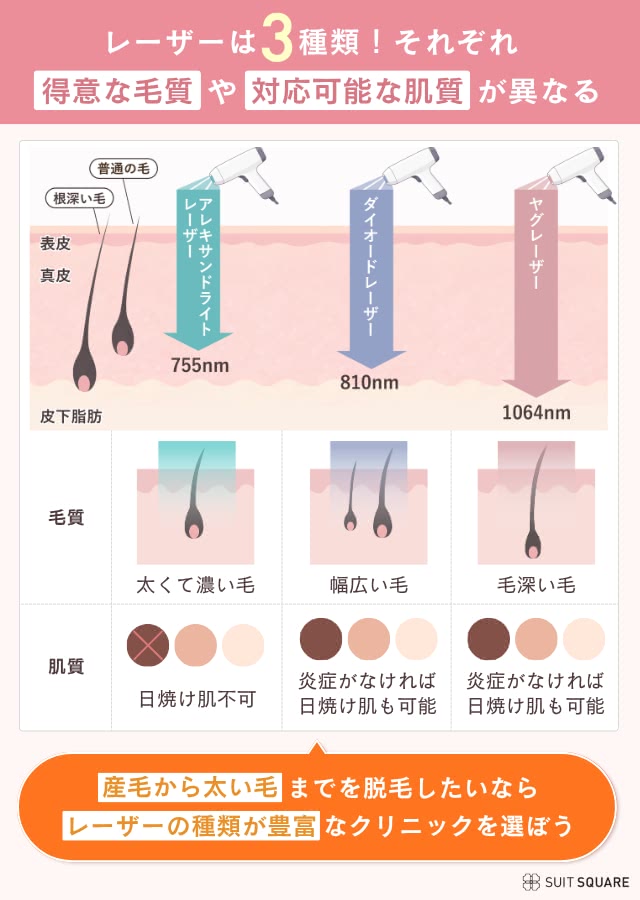 医療脱毛クリニックの選び方②レーザー