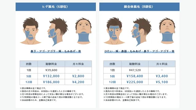 レジーナクリニックオムのヒゲ全体と顔全体脱毛プラン