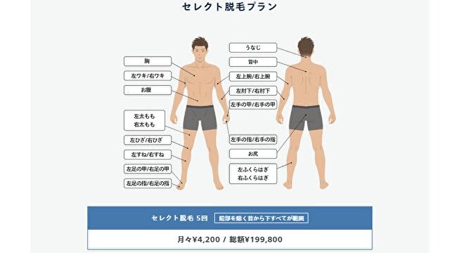 レジーナクリニックオムのセレクト全身脱毛プラン