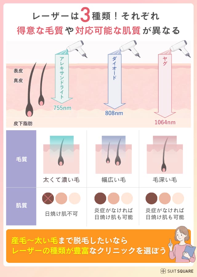 熱破壊式と蓄熱式の違い