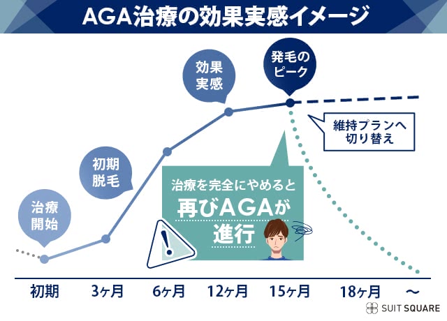 AGA治療の効果実感イメージ