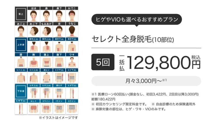 エミナルクリニックメンズ（メンズエミナル）のヒゲ脱毛3部位プラン
