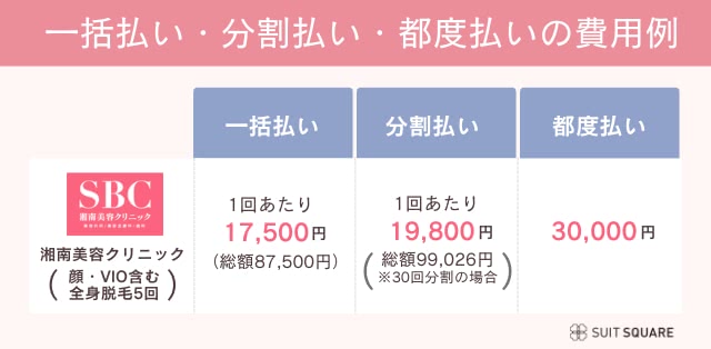 一括払い・分割払い・都度払いの費用例