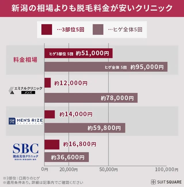 新潟でメンズのヒゲ脱毛をする場合に相場と比較