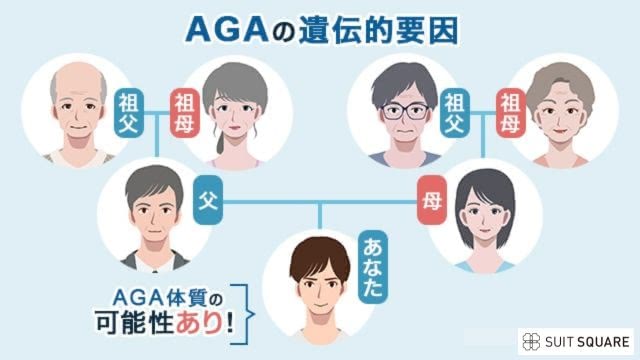 AGAが遺伝する家系図