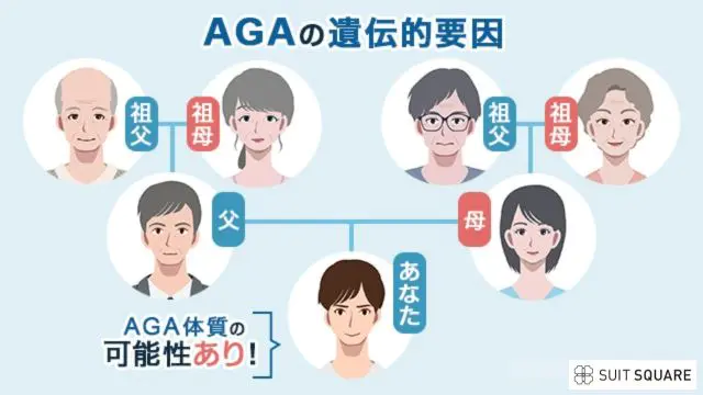 AGAが遺伝するイメージ画像