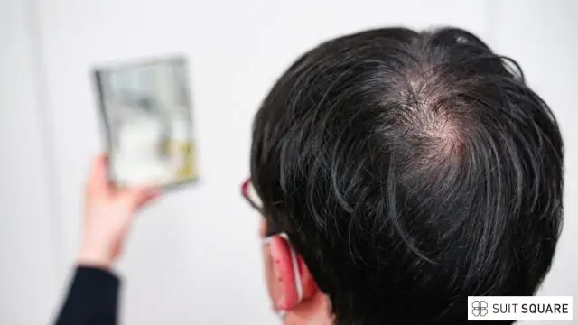 AGA患者のイメージ画像