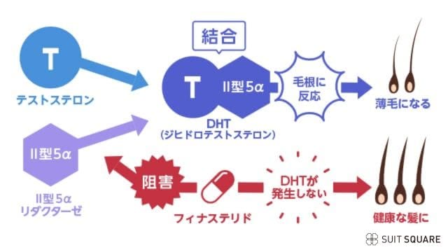 フィナステリドの作用